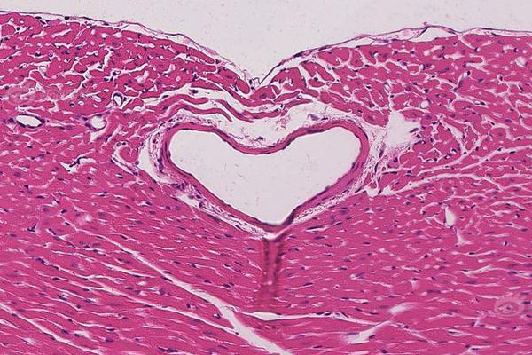 印尼洪災(zāi)遇難人數(shù)升【至6】04人